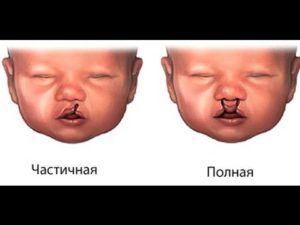 Мама из Новосибирска сумела добиться льгот на лечение своего ребёнка